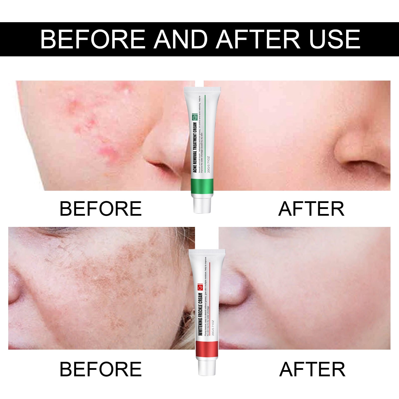 Alvantor Brightening Face Cream Moisturizer for Dull Skin & Acne Dark Spots 0.71 oz
