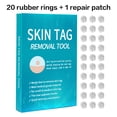 thumbnail image 1 of Kit de eliminación de manchas de verrugas lunares con etiqueta de piel sin dolor eficaz para una piel suave (02) Likrtyny cuidado belleza, 1 of 9