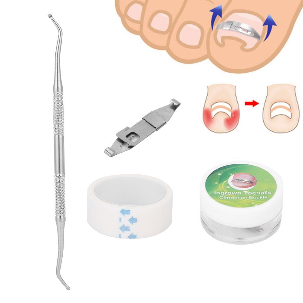 Tebru Ingrowing Nail Corrector, 3pcs Ingrown Toenail Corrector Paronychia Treatment Nail