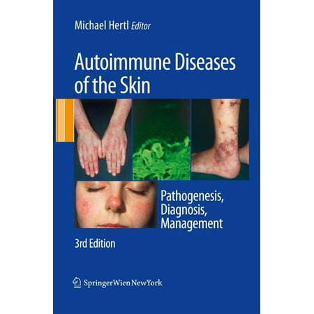 UPC: 9783211992241 | Autoimmune Diseases of the Skin: Pathogenesis  Diagnosis  Management (Hardcover)