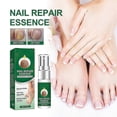 thumbnail image 2 of Nail Repair Essence Fungus Treatment Anti Fungal Infection For Toe Nail Nail, 2 of 5