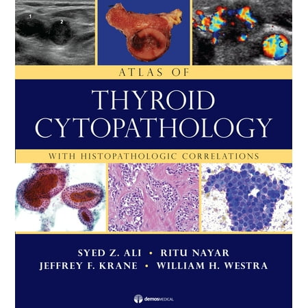 UPC: 9781933864952 | Atlas of Thyroid Cytopathology : With Histopathologic Correlations (Hardcover)