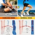 thumbnail image 5 of 3 Pairs Open Toe Zipper Medical Sport Compression Socks - 15-20mmhg Graduated Knee-High Support for Men & Women, Ideal for Soccer, Running, and Nurses, 5 of 7