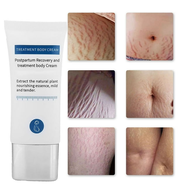 Crema para eliminar las estrías ANGGREK 30 g