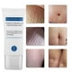 thumbnail image 1 of Crema para eliminar las estrías ANGGREK 30 g, 1 of 8
