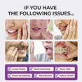 thumbnail image 3 of Pasta dental HEDGAUCP Tooth Refresh blanqueadora 2 unidades, 3 of 6