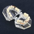 thumbnail image 4 of Tratamiento de Ortodoncia Dental de Maloclusión de Dientes Modelo con Cadena de Alambre Estudio Amonsee NO, 4 of 6