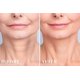 thumbnail image 4 of 18 piezas de parche de silicona antienvejecimiento, lifting de piel, reutilizable, para rostro, frente, cuello, ojos, eliminador de arrugas, adhesivo reparador, cuidado de la piel, 4 of 5