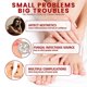 thumbnail image 4 of 2pcs Onychomycosis Rapid Relief Oil, Toenail Nail Treatment, Anti-Fungus Relief Oil, 4 of 5