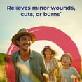 thumbnail image 2 of Boiron Calendula Officinalis 6C, Homeopathic Medicine for Minor Wounds, Cuts Or Burns, 80 Pellets, 2 of 10