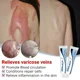 thumbnail image 4 of Cicatrices quirúrgicas de reparación efectiva, eliminación de cicatrices antiguas, estrías, acné, fosas, marcas de acné, quemadura, Scars090, 4 of 5