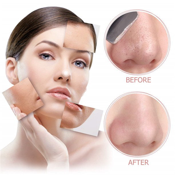Zendure Face Skin Scrubber, IPX5 Waterproof Skin Spatula Blackhead Remover  Pore Cleaner Face Scraper Beauty Device