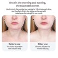 thumbnail image 3 of Anti Wrinkle Neck Face Lifting Device Led Photon Therapy Neck Skin Tightening Beauty Instrument Xfx, 3 of 5