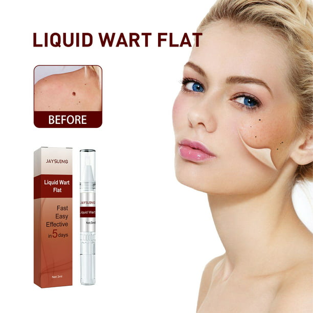 3ml Wipe Labels And Mole Removers, Wipe Skin Labels And Mole Removers