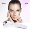 thumbnail image 5 of Kit de Rouleau Derma 6 en 1 pour Visage et Corps - Rouleau Derma Microneedle 0.25mm et 0.3mm avec 5 Têtes Remplaçables, Étui de Rangement et Réservoir de Désinfection, 5 of 5