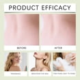 thumbnail image 6 of Tea Tree Oil Antibacterial Soap Bar for Face and Body, Natural Purifying Cleansing Block for Acne, Gentle Antiseptic Wash for Oily Skin, 100g Wrap for Daily Bath, 6 of 8