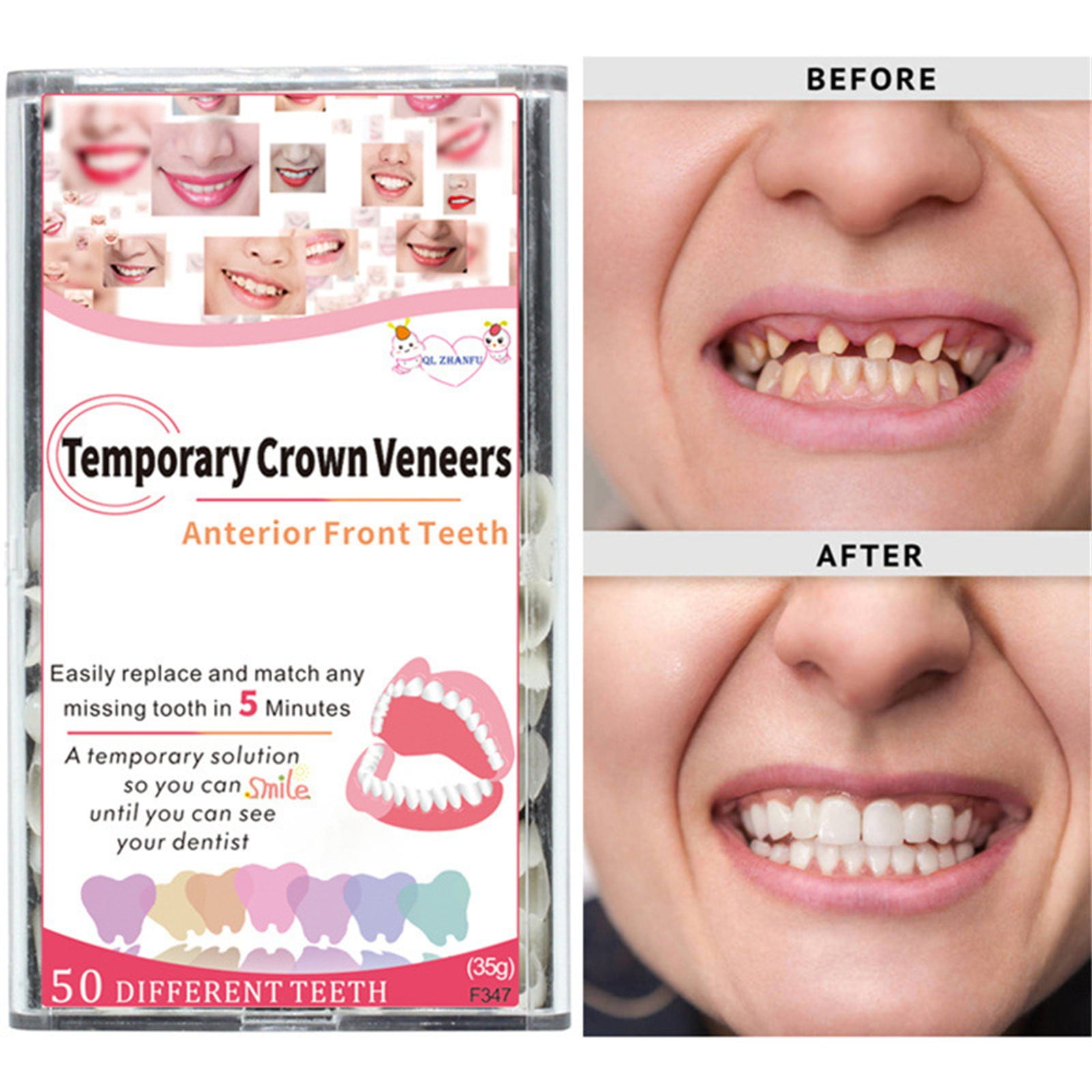 Teeth ning 22% Brush Kits Denture Bath Teeth Full Set Teeth Thermal Fitting Beads Bulk Wild Boar Teeth Teeth Filling for Brush Cup Travel Braces Straight Teeth Teeth Straightener for