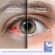 thumbnail image 4 of Mascarilla térmica para ojos CorneaCare Rest, compresa caliente autocalentable, 4 of 9