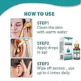 thumbnail image 5 of Gotas para los oídos contra el tinnitus, 10 ml, limpiador suave para los oídos, solución limpiadora para el tratamiento de infecciones de oído, 5 of 5