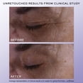 thumbnail image 3 of Sérum para ojos Lancôme Rénergie H.C.F. Triple Lift 20 ml, 3 of 8
