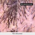 thumbnail image 3 of L'Oreal Professionnel Paris Serie Expert Scalp Advanced Anti-Dandruff Shampoo 500 ml, 3 of 4