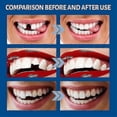 thumbnail image 4 of False Teeth Solid Glue Temporary Tooth Repair Kit Moldable Thermal Fitting, 4 of 4