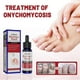 thumbnail image 2 of 1-6pcs EELHOE Toenail Fungus Treatment 50ml Anti Fungal Solution for Fingernails, Nail Repair, Toena, 2 of 5