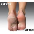 thumbnail image 4 of Rodillos de repuesto originales Emjoi Micro-Pedi (extra gruesos) de Emjoi, 4 of 5