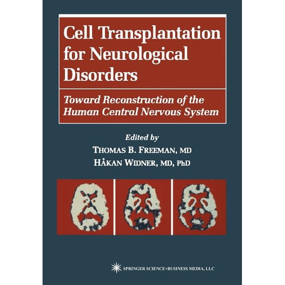 Contemporary Neuroscience Cell Transplantation for Neurological Disorders: Toward Reconstruction of the Human Central Nervous System, (Paperback)