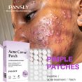 thumbnail image 1 of Fiudx Ofertas y liquidaciones Parche, parche hidrocoloide para control de aceite, suave y no irritante, 72 pegatinas, 1 of 7