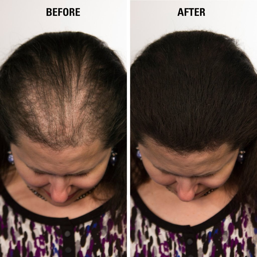 Infinity Hair Fibers For Thinning Hair Hair Thickening Fiber For