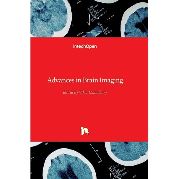 Advances in Brain Imaging (Hardcover)
