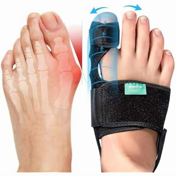 Welnove Bunion Corrector Women & Men Big Toe: 1 Pair Bunion Splint Brace - Adjustable Bunion Correction with Soft Gel - Bunion Pads for Pain Relief - Toe Straightener with Non-slip Strap