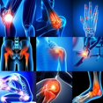 thumbnail image 2 of E27 275W Infrared Red Heat Light Therapeutic Therapy F5R9 Relief Pain R6J5, 2 of 7