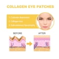 thumbnail image 6 of potrochi Collagen Smile Line Wrinkle Patches Face, 10 Pcs Anti Wrinkle Face Patches, Whole Face Wrinkle Patches to Reduce Fine Wrinkles, Frown and Smile Lines for Women & Men, 6 of 8