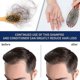 thumbnail image 4 of ximonth scalp care cream scalp deep nutrition dense hair repair hair follicle restore vitality luster bright, 4 of 4