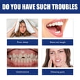thumbnail image 1 of 2pcs Jaw Alignment Brace, Repair Jaw After Retraction Teeth Uneven Deformity Buck Teeth Oral Care Support, 1 of 5