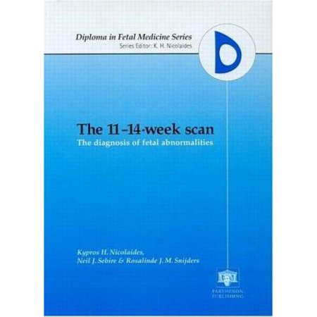 The 11-14-Week Scan: The Diagnosis of Fetal Abnormalities [Hardcover - Used]