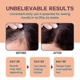 thumbnail image 3 of Raw Batana Oil for Hair Growth - 100% Pure, Organic Batana Hair Growth Oil from Honduras for Thick and Strong Natural Hair, 120ml, 3 of 5