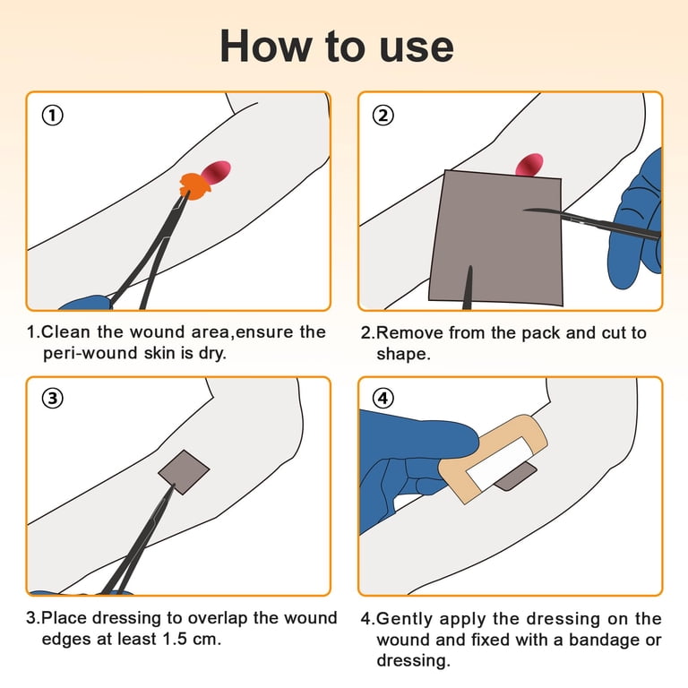 how to apply silver dressing Amazon.com: Ceeport Silver Calcium Alginate Wound Dressing, 4" x 4"  Patches, Highly Absorbent Dressing Gauze, Non Stick Pads for Wounds, Soft  and Comfortable Silver Dressing for Wound Care, 5 Packs : Industrial