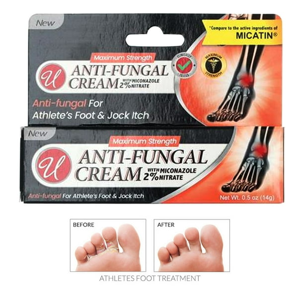 1 Antifungal Cream Miconazole Nitrate 2 Athletes Foot Jock Itch