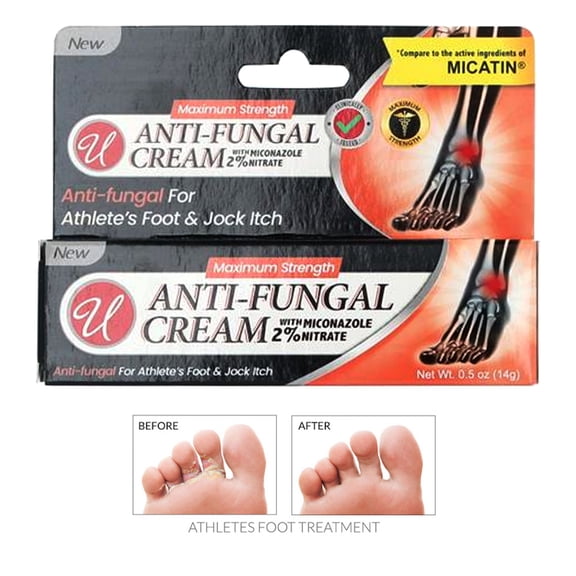 1 Miconazole Nitrate 2% 0.5 Oz Antifungal Cream Athletes Foot Jock Itch Itching