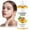 yellow, variant on HYLLai Turmeric Vitamin C Facial Toner, Antioxidant Brightening Toner, Improves Elasticity, Evens Skin Tone, Refreshing Hydrating, For All Skin, 100ml