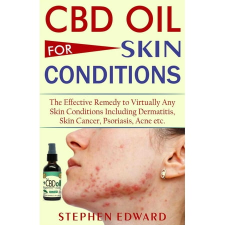 CBD Oil for Skin Conditions: The Effective Remedy to Virtually Any Skin Conditions Including Dermatitis, Skin Cancer, Psoriasis, Acne etc. -