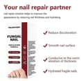thumbnail image 5 of 15ml Fungi Nail Treatment Liquid Fast-acting Nail Repair Strengthening Liquid Nails Care Supplies, 5 of 5