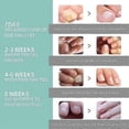 thumbnail image 4 of Fungal Nail Treatment Pen for Toenails and Fingernails, Anti Fungus Nail Strengthener for Ingrown & Thick Nail Infection Treatment New Arrival, 4 of 5