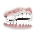 thumbnail image 4 of Plackers Grind No More Dental Night Guard, 16 Count, 4 of 7