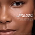 thumbnail image 6 of Vichy Laboratoires Normaderm S.O.S Acne Rescue Spot Corrector 0.68oz  New With Box, 6 of 6