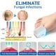 thumbnail image 5 of Dispositivo láser para hongos en las uñas, terapia de luz, onicomicosis, tratamiento de dedos de los pies, recargable, 5 of 5