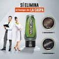 thumbnail image 4 of Shampoo Medicasp anticaspa uso diario 400 ml, 4 of 4